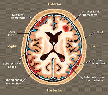 Image result for Three pictures that represent how child neglect cause brain damage.