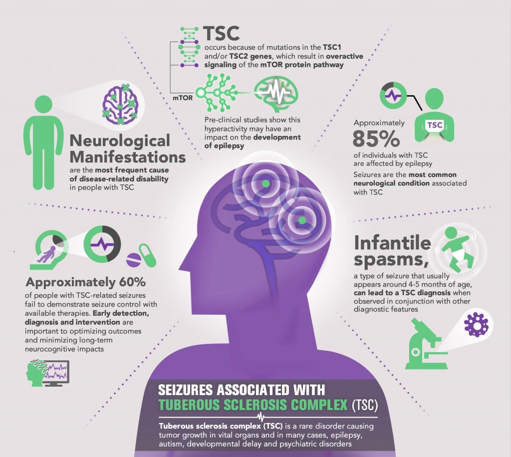 Tuberous Sclerosis Complex Child Neurology Foundation