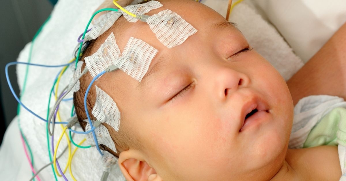 Infantile Spasms - Child Neurology Foundation