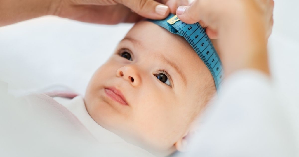Megalencephaly - Child Neurology Foundation